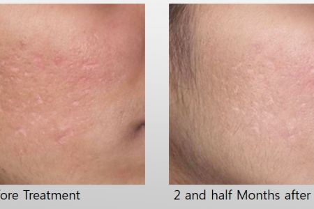 Infini-Before-After-32.jpg