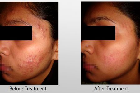 Infini-Before-After-31.jpg