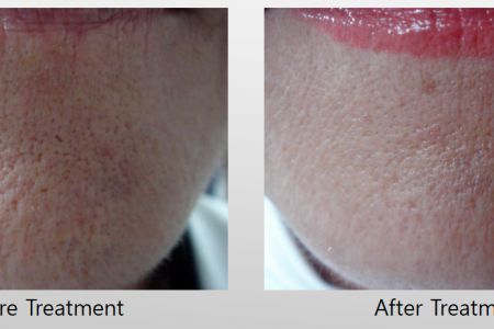 Infini-Before-After-13.jpg