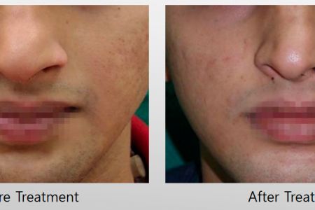Infini-Before-After-38.jpg