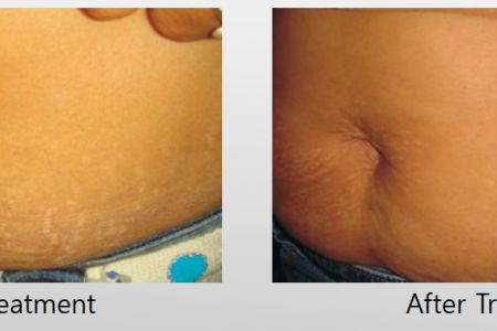 Infini-Before-After-47.jpg