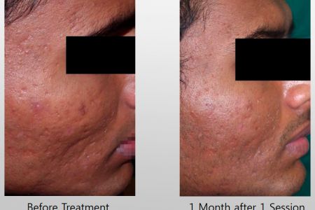 Infini-Before-After-40.jpg