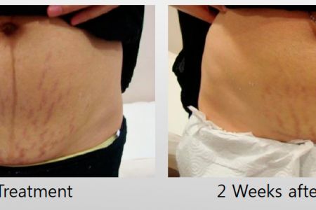 Infini-Before-After-46.jpg