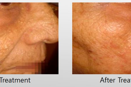 Infini-Before-After-14.jpg