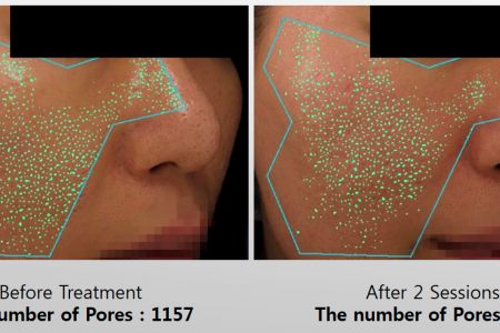 Infini-Before-After-19.jpg