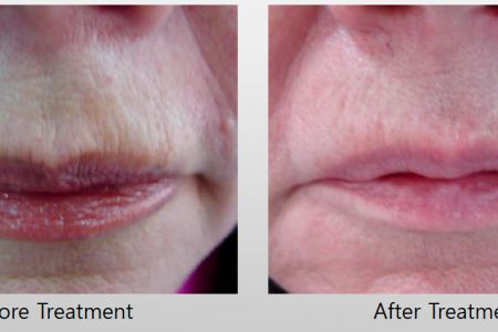 Infini-Before-After-12.jpg
