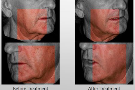 Infini-Before-After-16.jpg